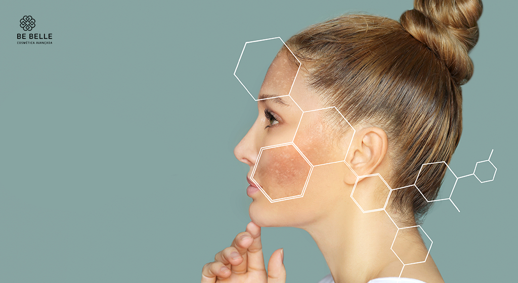 Melasma: Como Tratar Manchas Escuras com a Nova Geração de Dermocosméticos